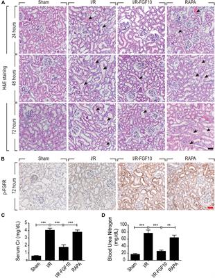 FGF10 Protects Against Renal Ischemia/Reperfusion Injury by Regulating Autophagy and Inflammatory Signaling